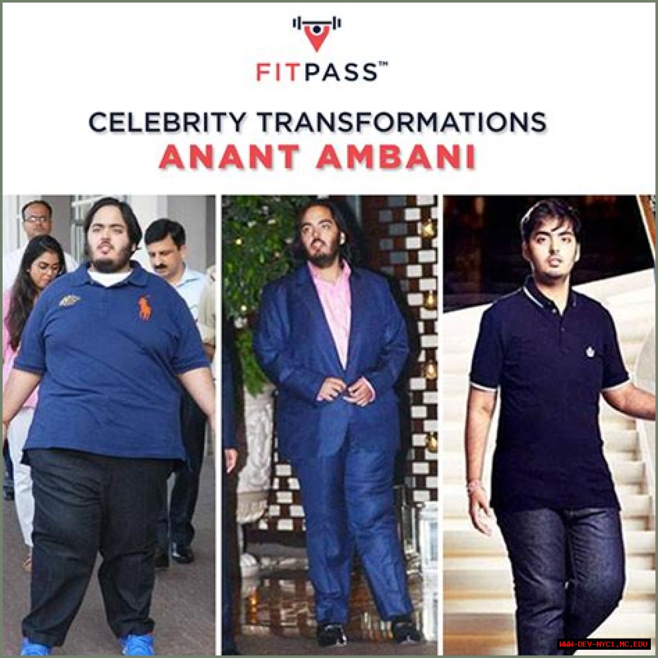 Anant Ambani: Understanding His Mental Condition