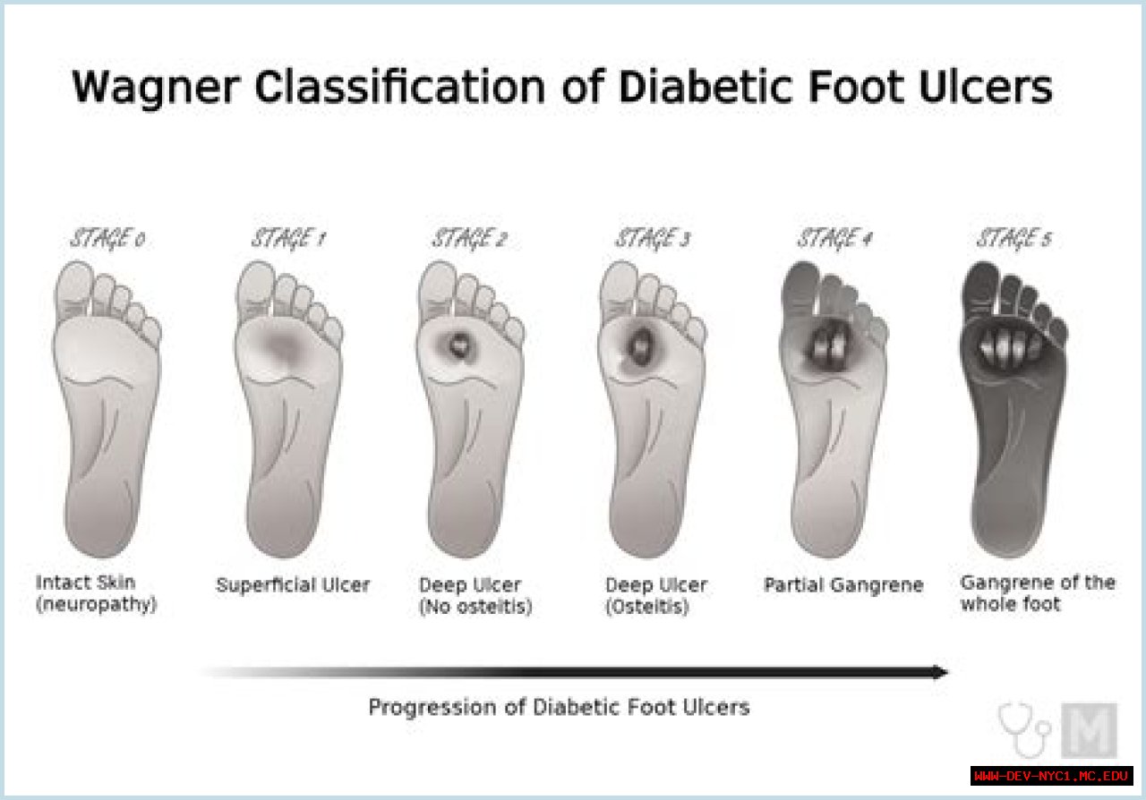 Understanding The Impact Of Alex Wagner's Divorce On Her Career And Personal Life